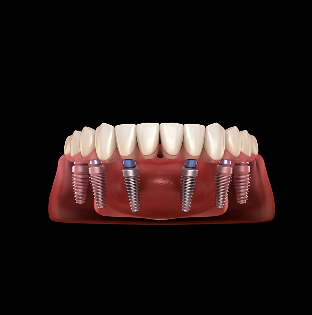Clínica Dental en Alcorcón