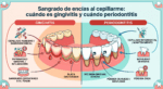 Sangrado de encías al cepillarme