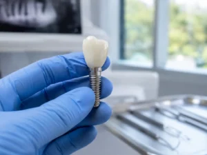 Protesis dental fija o removible