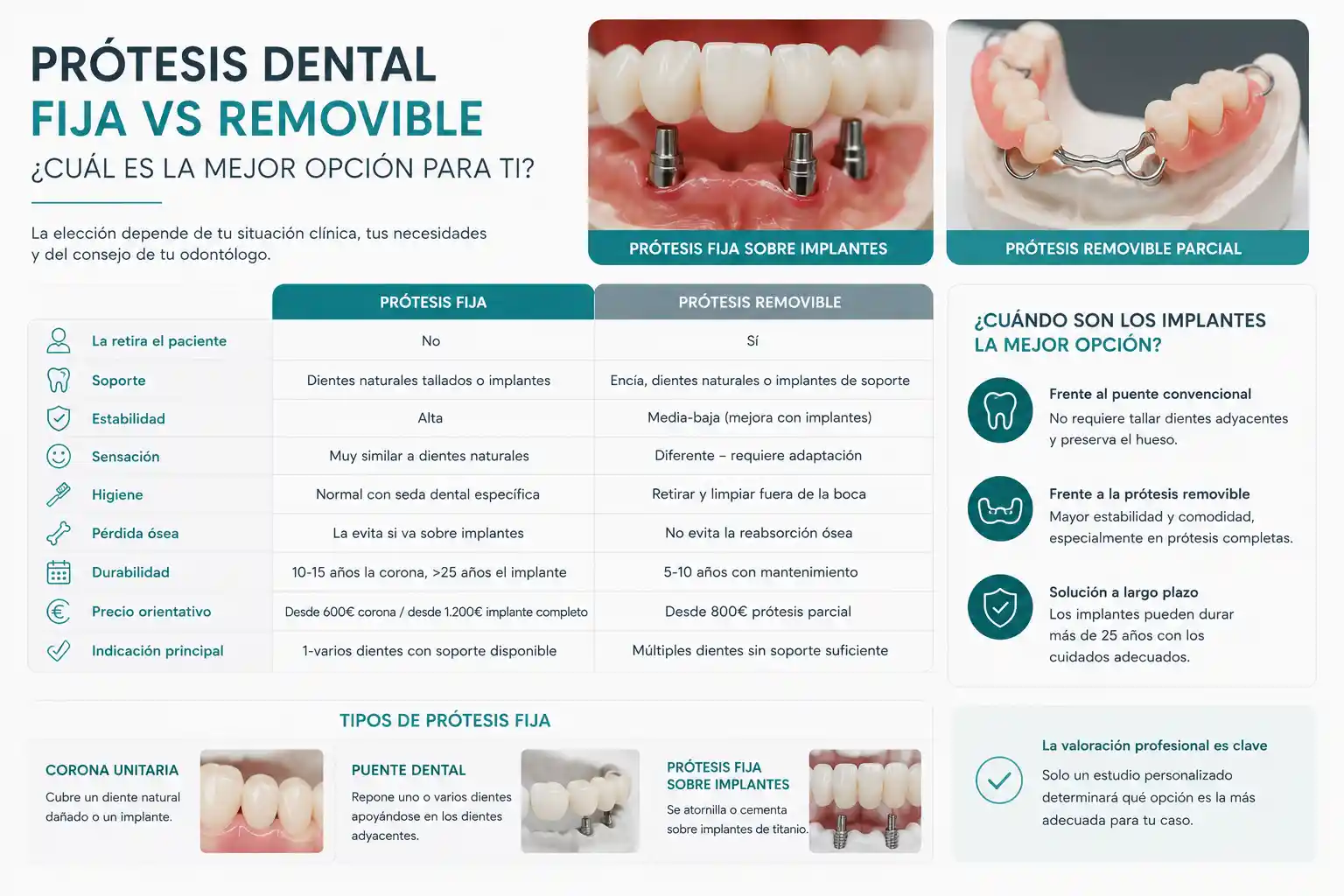 protesis dental fija o removible